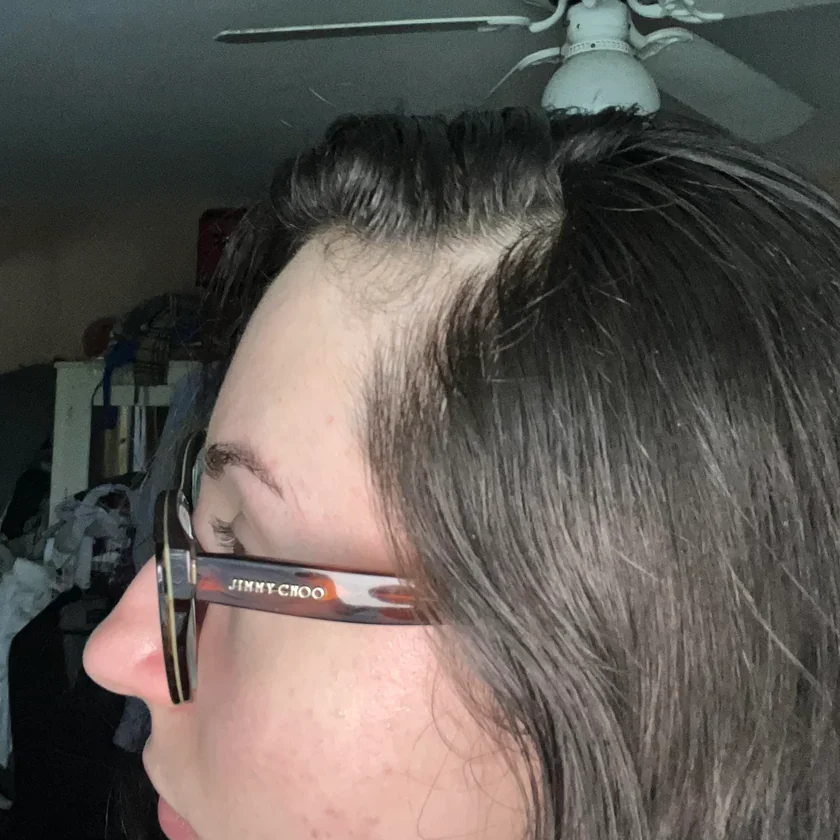 Before