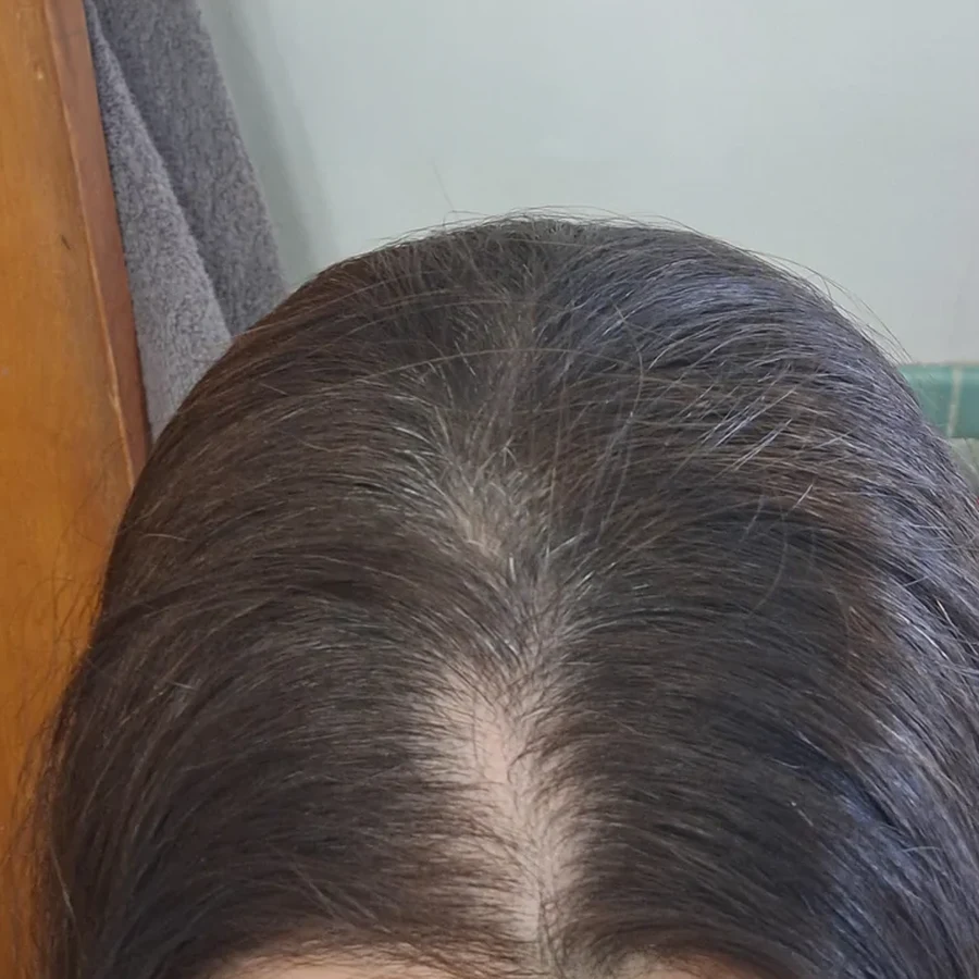 Day 1